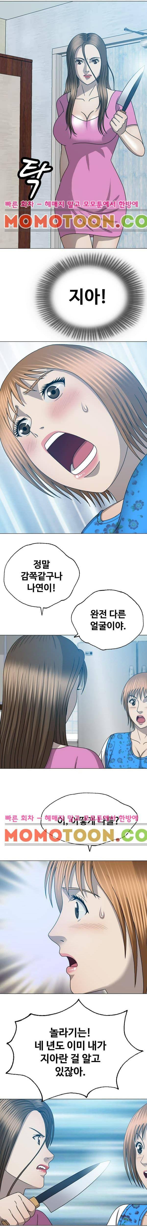 성형 31화 3
