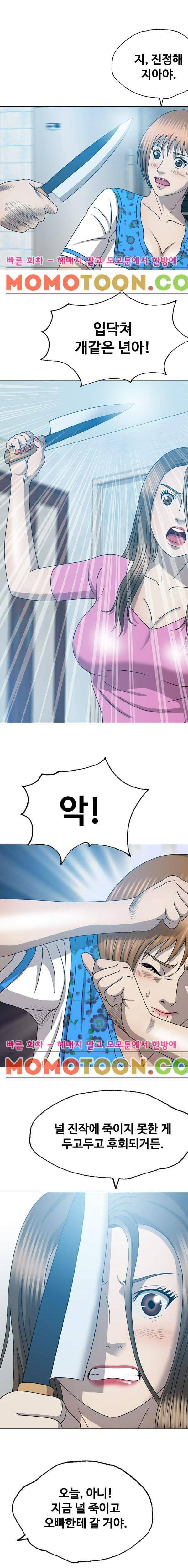 성형 31화 4