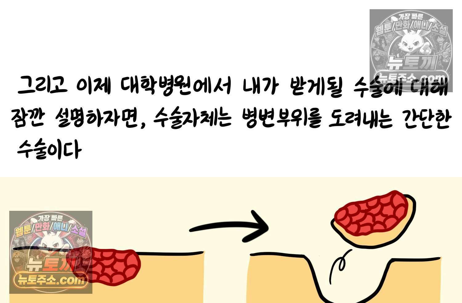 재활용 머학생 103화 암환자(3) 58